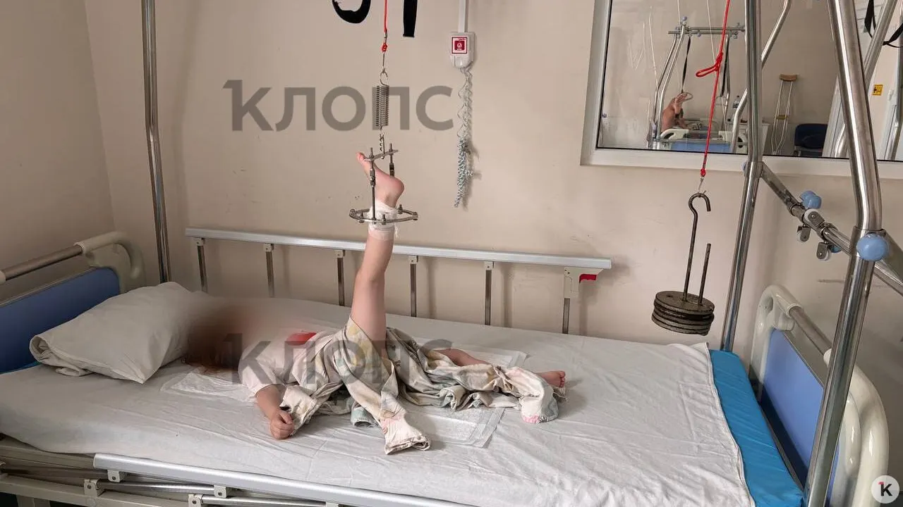 Ребёнка отвезли в больницу отец после того, как воспитатели диагностировали «ушиб» и не вызвали врачей; рентген показал перелом бедра со смещением, проводится проверка прокуратуры.